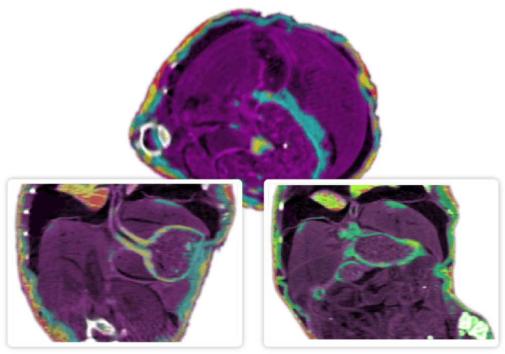 Spectral computed tomography slices where each colour represents a tissue type. Picture taken by AdvaPIX